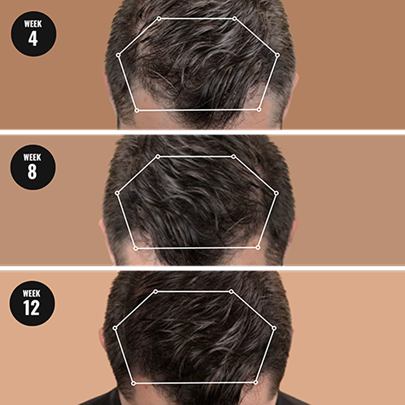 Complete Hair Health System