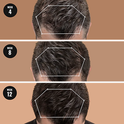 Complete Hair Health System