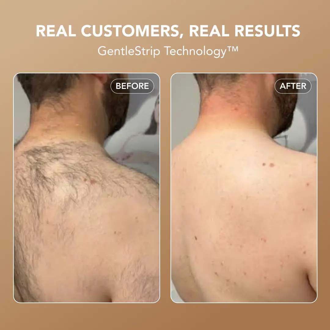 Razorless Body Hair Removal Cream™