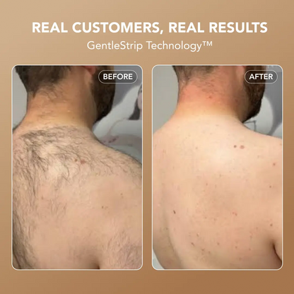 Razorless Body Hair Removal Cream™