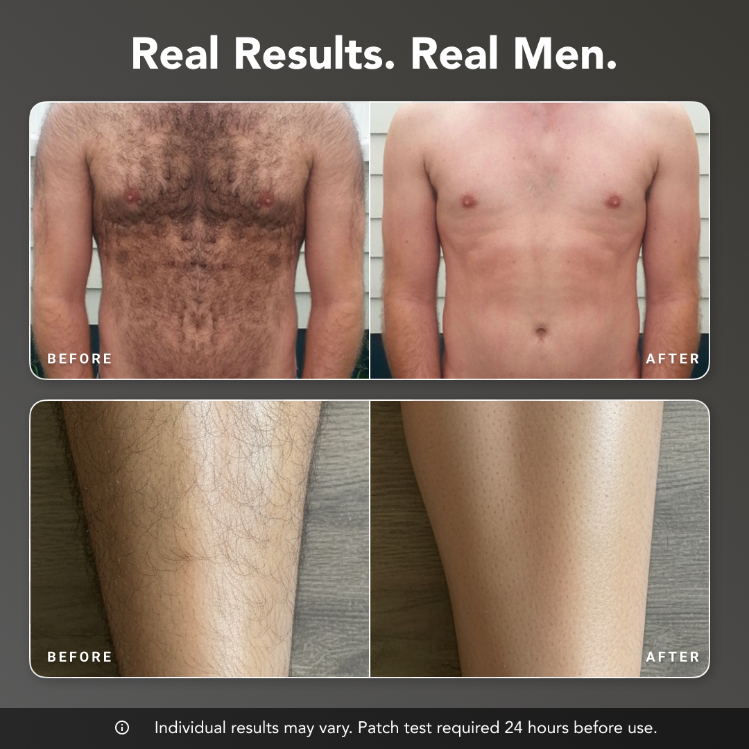 Razorless Body Hair Removal Cream™
