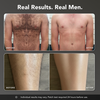 Razorless Body Hair Removal Cream™